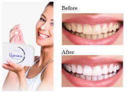 Kit de blanchiment des dents avec service OEM