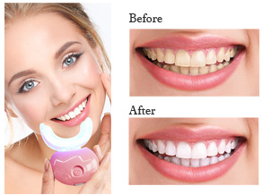 Merci beaucoup pour votre réponse complexe